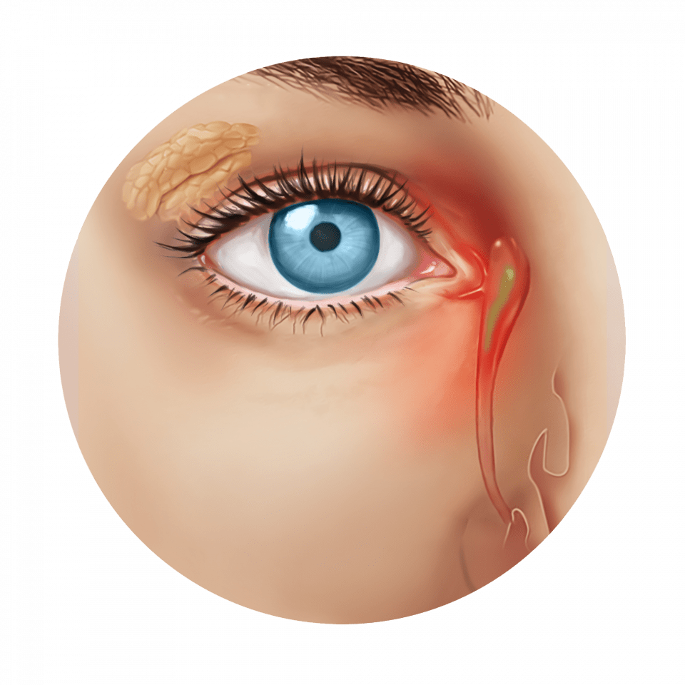 Eye anatomy Eye anatomy diagram Eye anatomy and physiology Eye diseases Eye disorders Eye conditions Eye problems Eye symptoms Eye complications Eye emergencies Eye trauma Eye surgery recovery LASIK recovery Cataract surgery recovery Glaucoma symptoms Retinal disease Macular degeneration treatment Diabetes and eye health High eye pressure Low eye pressure Eye pressure test Eye prescription Vision prescription Contact lens fitting Contact lens care Eye drops Eye vitamins Eye exercises Eye surgery cost LASIK cost Cataract surgery cost Eye insurance Medicare eye coverage Medicaid eye coverage Vision insurance Glasses frames Sunglasses Designer glasses Sports eyewear Occupational eyewear Safety glasses Eye surgery risks LASIK risks Cataract surgery risks Glaucoma risk factors Eye health and nutrition Eye health supplements Eye health vitamins Eye health diet Eye health foods Eye health benefits Eye health check-up Routine eye exam Comprehensive eye exam Pediatric eye exam Annual eye exam Eye exam for children