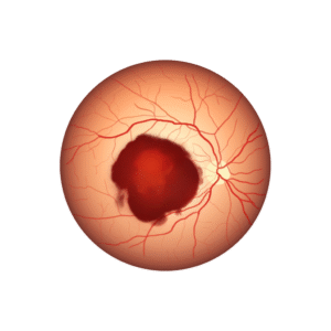 test de la vue, test de l'acuité visuelle, test de champ visuel, vitrectomie, angiographie rétinienne, injection intraoculaire, phacoémulsification, Phaco Chirurgie de cataracte sans suture Chirurgie de cataracte par laser examen de la vue pour enfants, examen de la vue pour adultes, examen de la vue complet, examen de la vue annuel, examen de la vue pour diabète, examen de la vue pour glaucome, examen de la vue pour cataracte, examen de la vue pour rétine