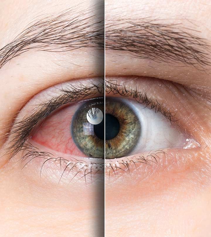 Stress et yeux Ophtalmologue à Fès