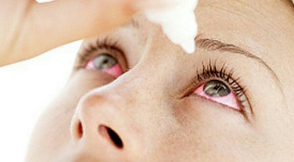 Sécheresse des yeux – Ophtalmologue Fès