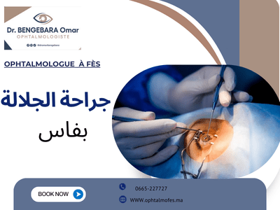Dr Bengebra Omar ophtalmologue Fès :جراحة الجلالة